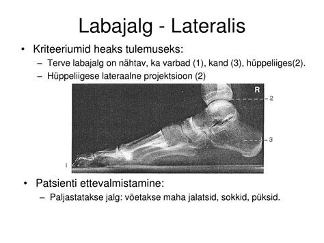 METATARSAALLUUD